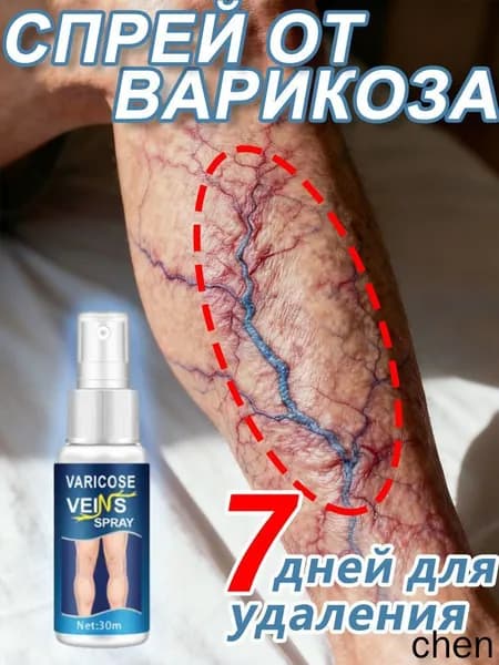 Средство от варикоза с натуральными растительными экстрактами, улучшает циркуляцию крови и снижает отечность ног, 30 мл
