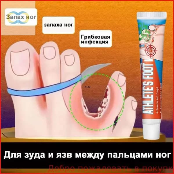 Средство от запаха ног для зуда и язв между пальцами, против грибка, дезодорант эффективное 20г