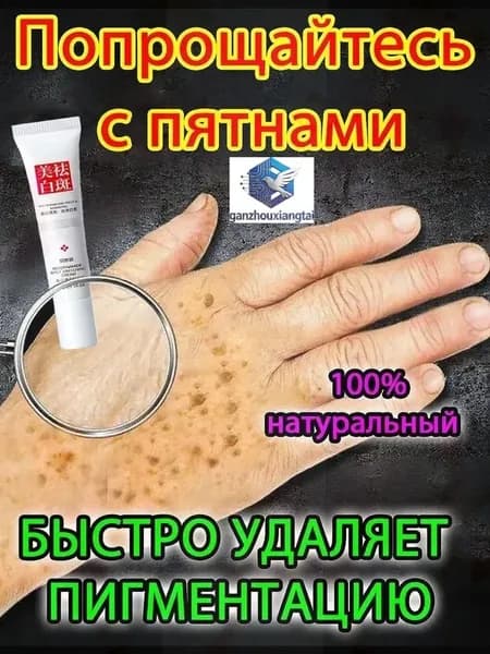Отбеливающий крем от веснушек и солнечных пятен, подходит для удаления и исчезновения желтых пятен и старчес