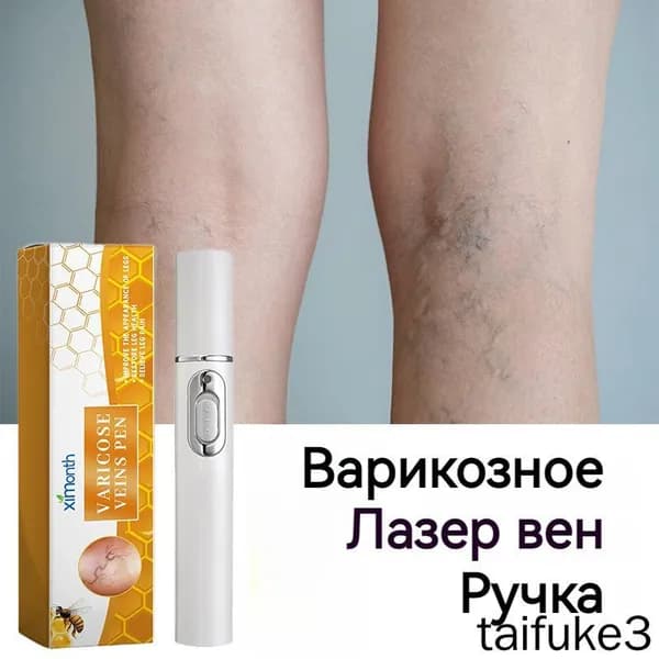 Ручка для лечения варикозного расширения вен,использовать для лечение сосудистых звездочек, тромбоза,отеков и тяжести в ногах,улучшает кровообращение