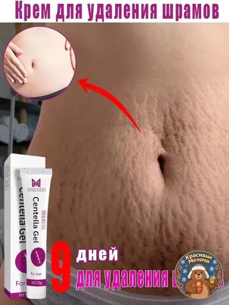 Средство от растяжек