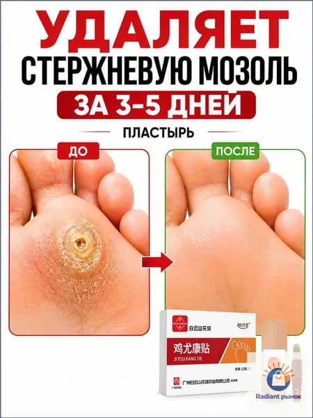 Качественный пластырь для удаления бородавок, стержневых мозолей и натоптышей, 12 штук