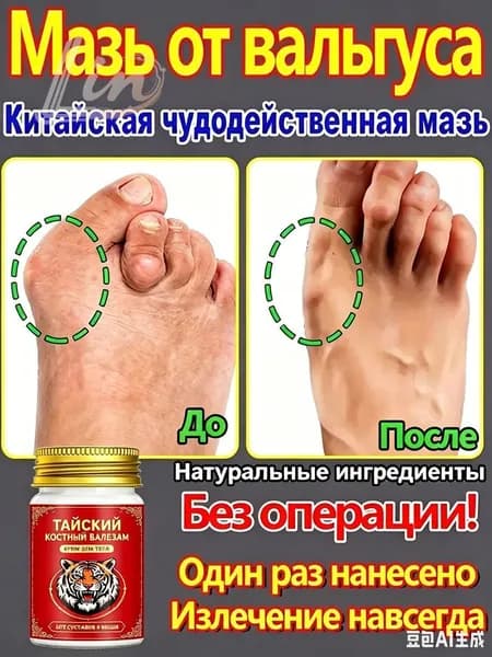 Крем при вальгусной деформации, от шишек на больших пальцах ног, Боль в суставах, подагра20 г