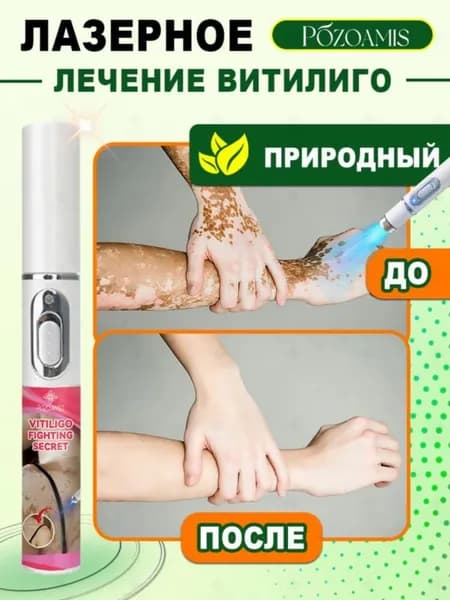 Лазерная ручка для лечения витилиго 0715