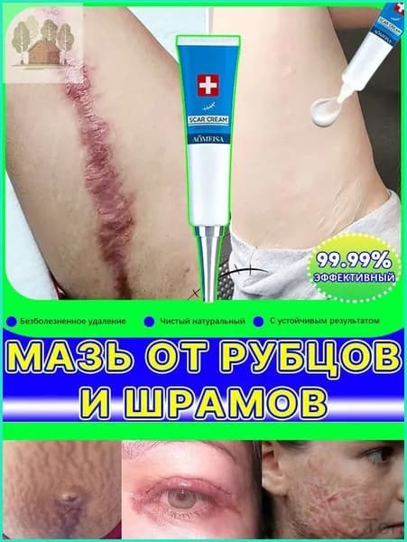 Гель от рубцов: для лечения растяжек, угревой сыпи, ожогов, послеоперационных и келоидных рубцов, 20 мл