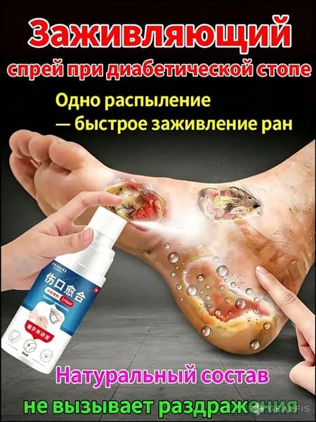 Мазь для лечения диабетической стопы и пролежней: заживление ран и регенерация кожи при сахарном диабете