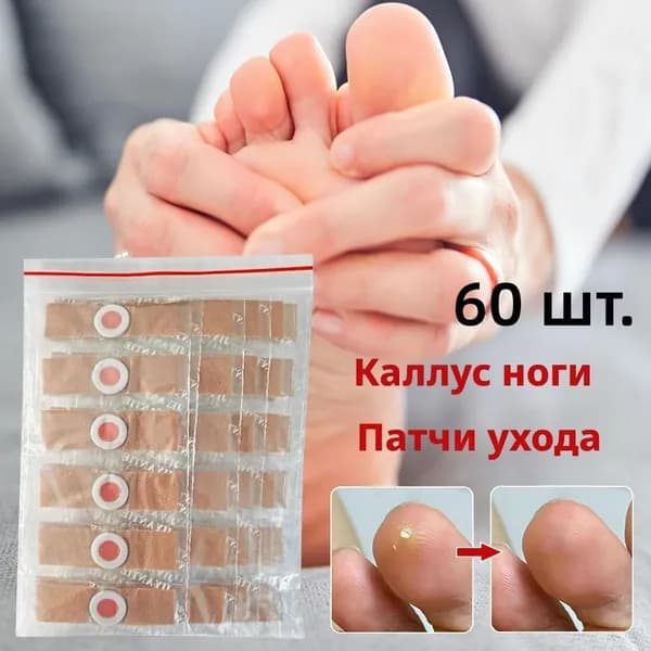 Пластырь бактерицидный, лейкопластырь лечебный для ног от сухих мозолей и натоптышей 60 шт.