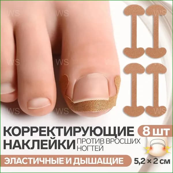 Качественный корректор от вросшего ногтя
