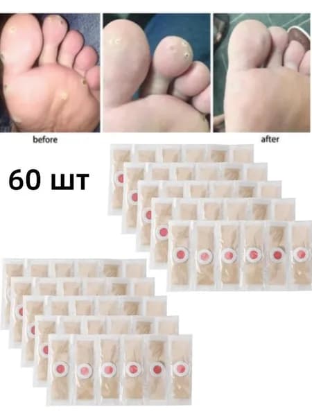 Пластырь для похудения