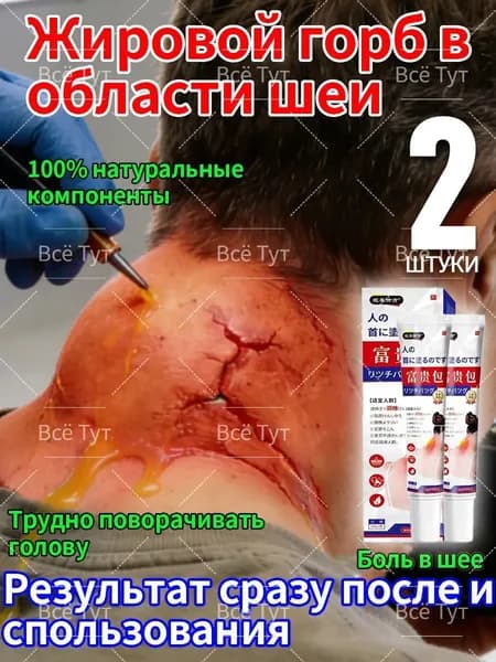 мазь для устранения жирового образования на шее,2 штуки