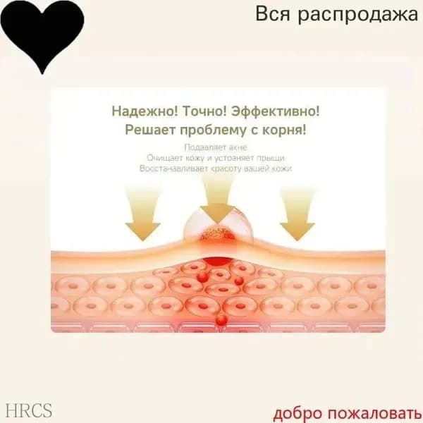 Цинковый крем,Гель от прыщей, прыщей, акне, постакне для наружного применения.Мазь цинковая от прыщей увлажняющая, точечное средство для подростков и взрослых 30 г.