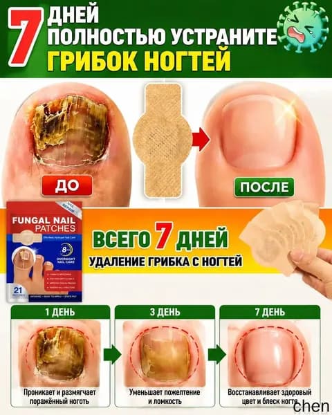 Антигрибковые наклейки,Пластыри от грибка ногтей, лечение онихомикоза, восстановление и защита ногтей, против грибка, 21 шт