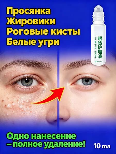Крем от жировиков милиумов от просянки белых угрей