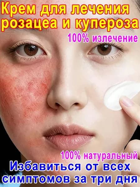 Крем для лица от купероза, розацеа, покраснений "Тонус-Капилляр Лица".для проблемной кожи,100% натуральный В безгормональном составе.20 мл