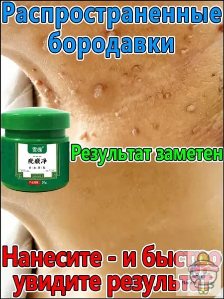 Средство для удаления кератом