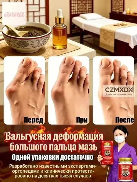 Крем при вальгусной деформации, от шишек на больших пальцах ног,55 мл/Быстродействующие обезболивающие