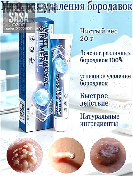 Эксклюзивное средство для удаления папиллом, бородавок, кондилом и ороговевших участков кожи, объем 20 грамм