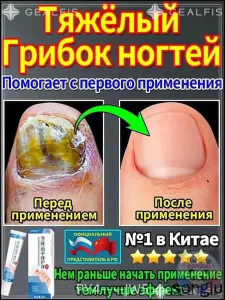 мазь ноготок от грибка ногтей на ногах,Лечите грибковые инфекции, укрепляйте и восстанавливайте ногти и роговой слой кожи, а также устраняйте грибок ногтей на ногах. Выбор панды