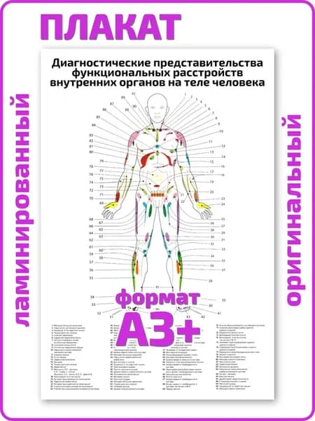 Диагностические представительства расстройств плакат А3