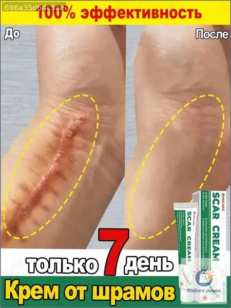 Крем от шрамов и рубцов, гель от прыщей на лице, мазь против ожогов и пигментных пятен и теле, средство от постакне30 г