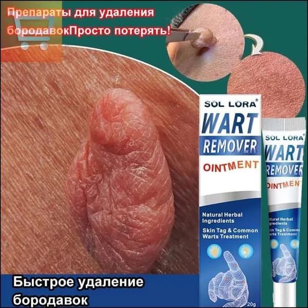Мазь от бородавок, Крем средство для удаления бородавок, папиллом и родинок, безболезненно, не оставляет следов без побочных эффектов / 20г