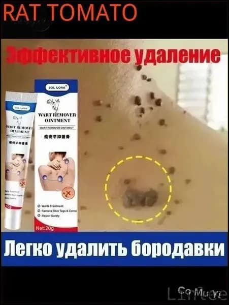 Гель с чистотелом для удаления бородавок, папиллом и мозолей, 20 г