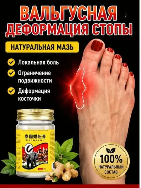 Мазь при вальгусной деформации косточки обезболивающая 55 г