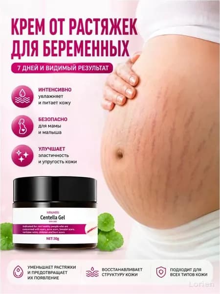 крем от растяжек для беременных,От целлюлита и растяжек, для восстановления упругости кожи,восстанавливает кожу,30 мл