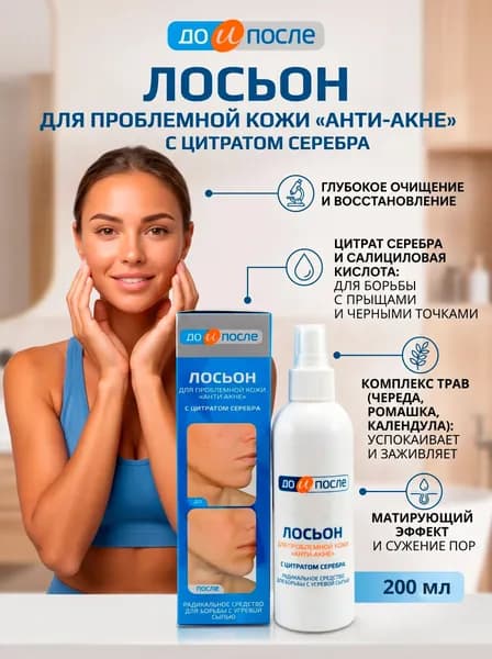 Анти-Акне лосьон для проблемной кожи, 200 мл