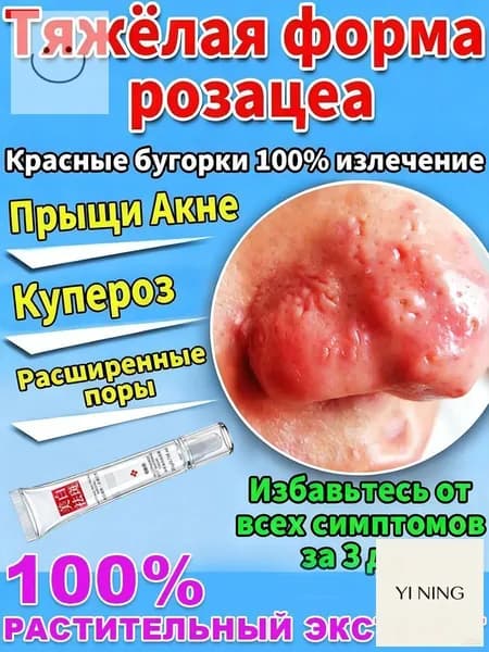 DTMS Сыворотка для лица с азелаиновой кислотой 10% и скваланом от прыщей, восстанавливающий крем, винная мазь ор