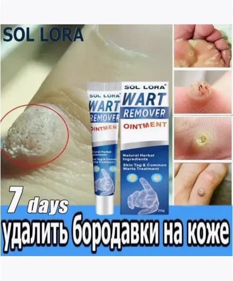 Крем против бородавок SOL LORA anti-wart flat для удаления бородавок