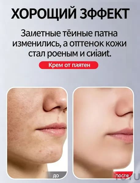 Крем для отбеливания веснушек, осветление пигментных пятен, меланодермия, подбитый глаз 20g 4 шт