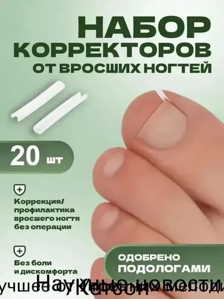 Корректор От Вросших Ногтей На Ногах