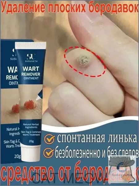 Средство от папиллом и бородавок(Совершенно новая версия ), для удаления бородавок папиллом, сухих мозолей на ногах и теле, мазь для ухода за кожей, безболезненно, не оставляет следов 20 г