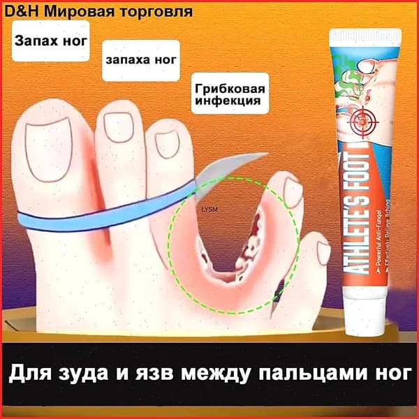 Средство от запаха ног для зуда и язв между пальцами, против грибка, дезодорант эффективное 20г