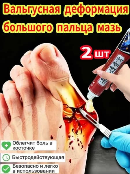 2 шт Мазь при вальгусной деформации стопы подагре шишках