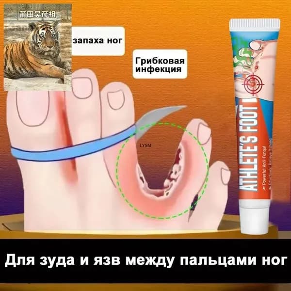 Средство от запаха ног для зуда и язв между пальцами, против грибка, дезодорант эффективное 20г