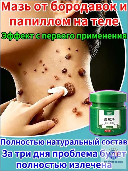 Мазь от бородавок, папиллом и натоптышей