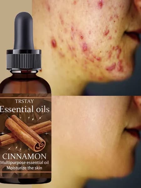 Эссенция для ухода за кожей, 15 мл