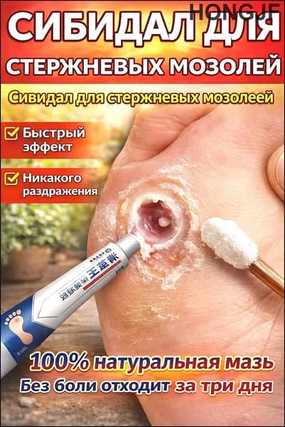 Средство от шипиц, натоптышей и сухих стержневых мозолей на ногах мазь и гель Корнекс,эффективное китайское средство