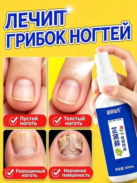 Спрей от онихомикоза масло от грибка ногтей на ногах.Средство от грибка ногтей на ногах