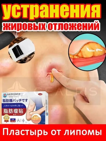 Пластыри от липомы/Быстрое устранение липомы, прыщей, лимфаденита и т Шишка в области подмышек12 шт/коробка
