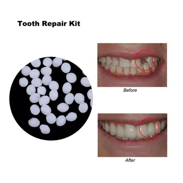 Твердый зубной клей, DIY, вампирские зубы