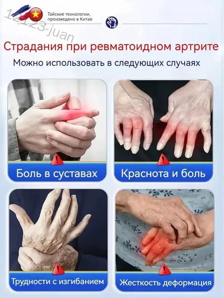 Мазь от артрита рук и ревматоидный артрит для суставов 50 r