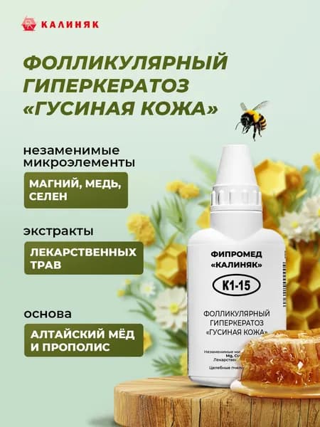 Фипромед Калиняк К1-15: Фолликулярный гиперкератоз "Гусиная кожа", 50 мл