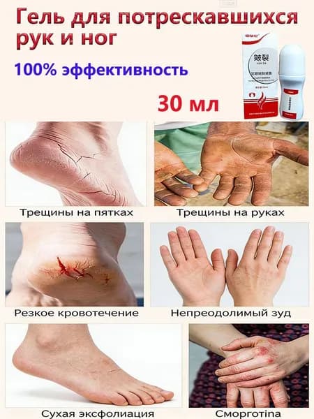 30 Г Крем Для Ног Против Трещин, Восстанавливает Потрескавшиеся Пятки, Удаляет Омертвевшую Кожу И Мозоли, Предотвращая Сухость, Ухаживает За Кожей Рук И Ног.1 шт