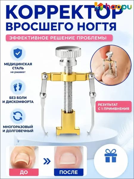 Коррекция вросших ногтей