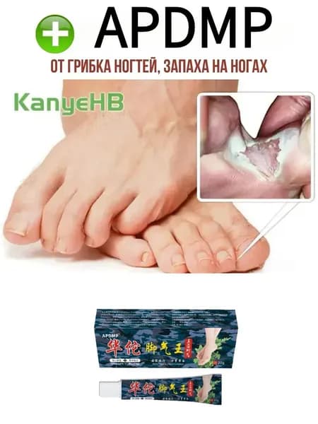 Китайский крем мазь от грибках на ногах защита стопы