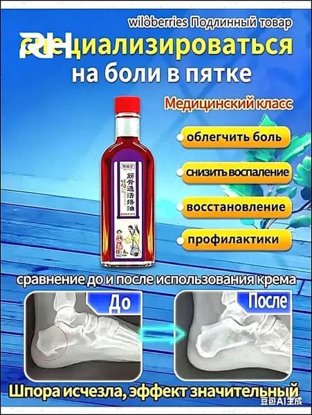 медицинская желчь для пяточной шпоры жидкая 51 г