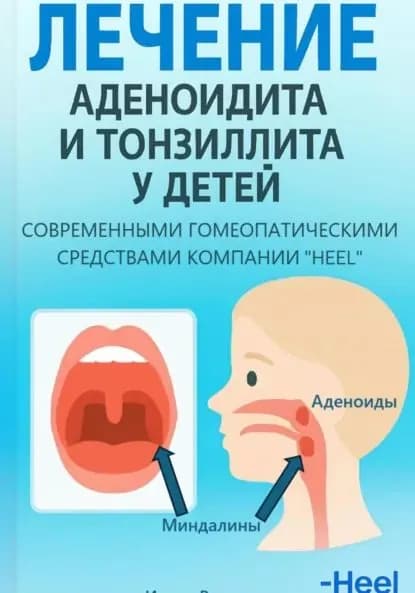 Лечение аденоидита и тонзиллита у детей современными комплексными гомеопатическими препаратами фирмы Хеель | Ирина Ивановна Романова | Электронная книга